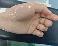 �ֺ����ǲ���