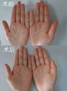 <b>�ֺ�֢Ϊ�ι���������Ʒ��룿</b>