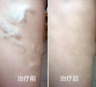 <b>����������ôԤ����</b>