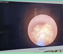 <b>���ܿ�ѹ���������ȡʯ�������ƣ�</b>